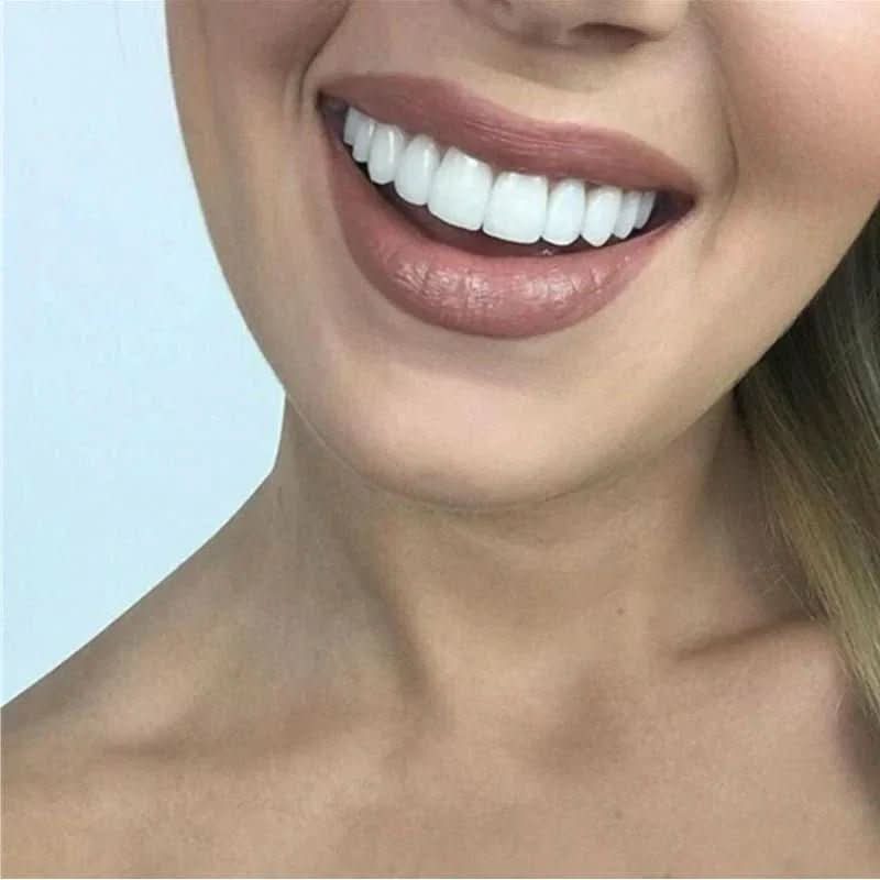 Snap-On Tooth Cover with Heat-Moldable Design and Reusable Use