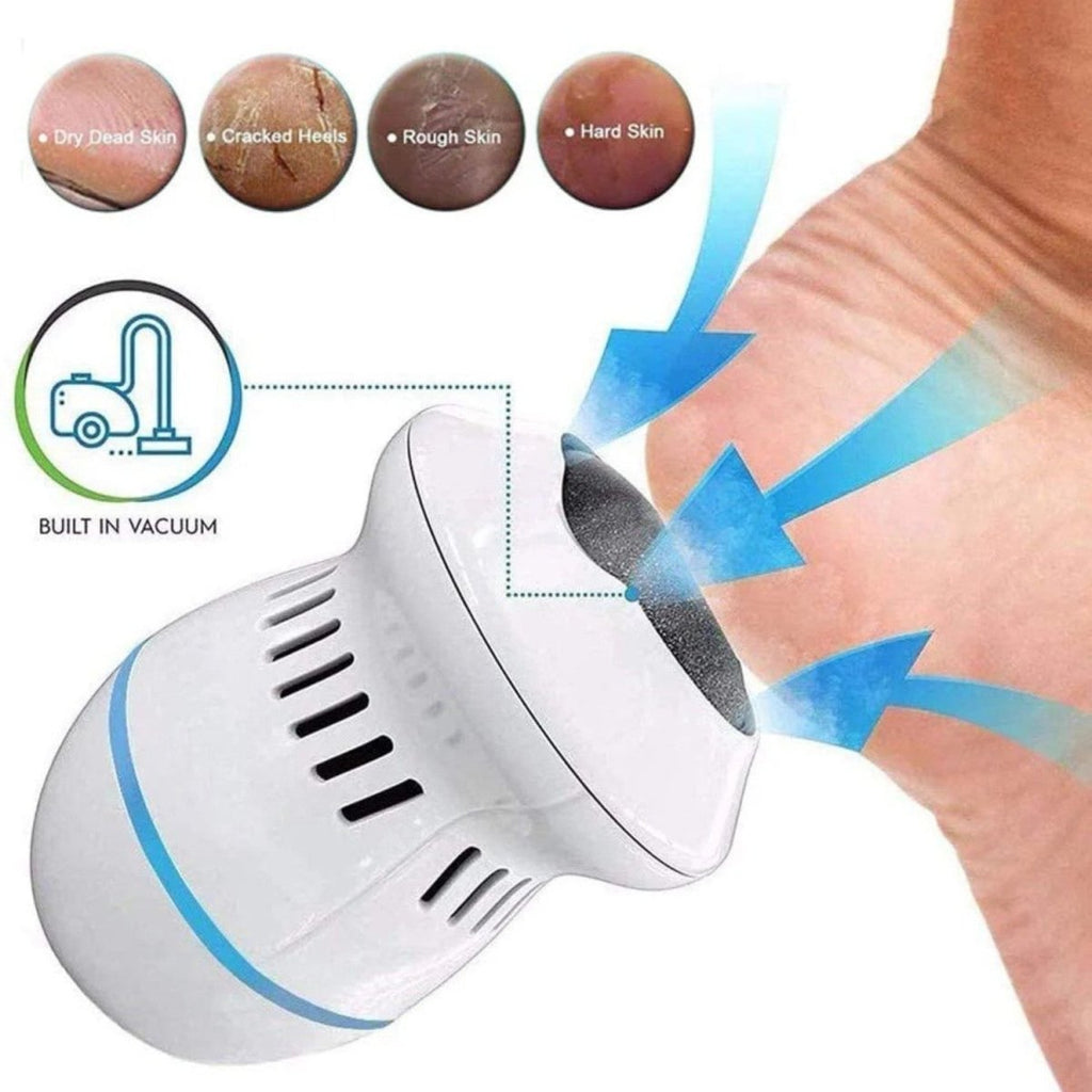 Electric Foot Grinder for Smooth Feet