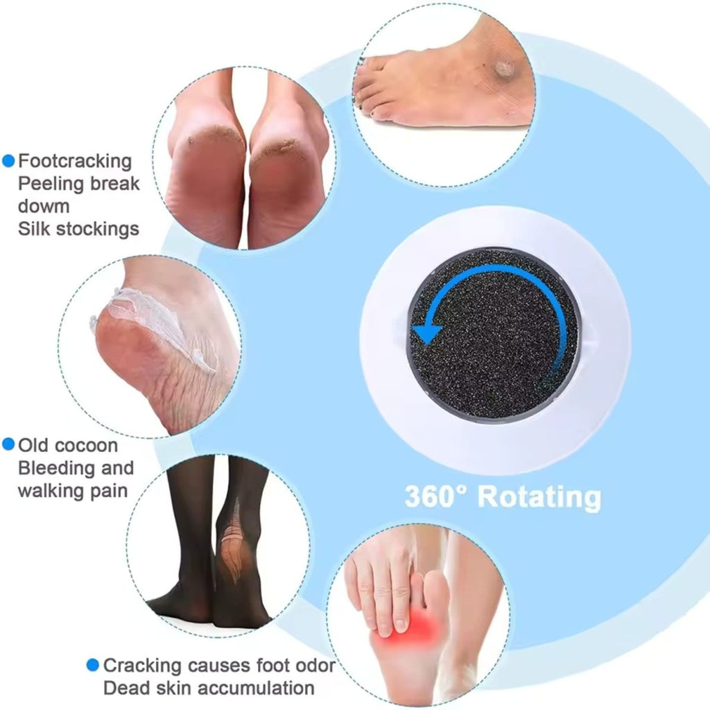 Electric Foot Grinder for Smooth Feet